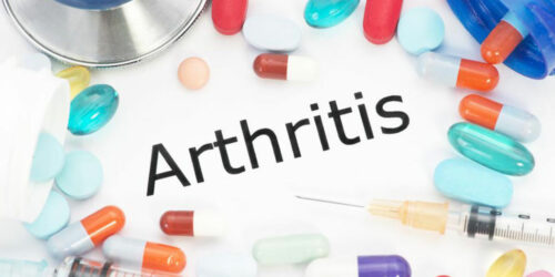 Arthritis &#8211; Classification and treatment