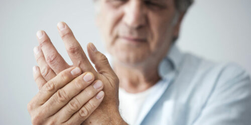 Arthritis &#8211; Types, signs and risk factors