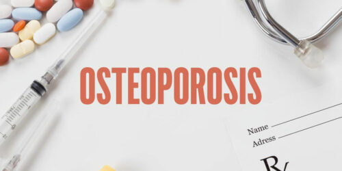 Bone density testing &#8211; An important diagnostic tool for osteoporosis