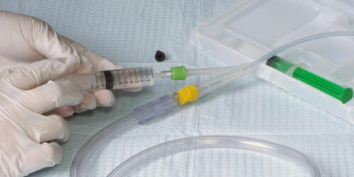 Brief information on catheters for men