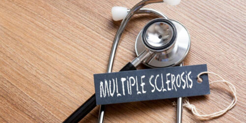 Diagnosis and treatments of multiple sclerosis