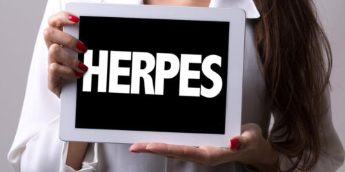 Effective alternative treatments to cure herpes