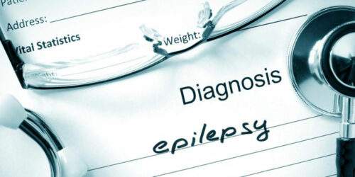 Everything you need to know about epilepsy