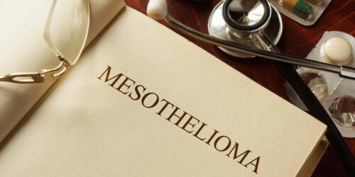 Everything you should know about Mesothelioma