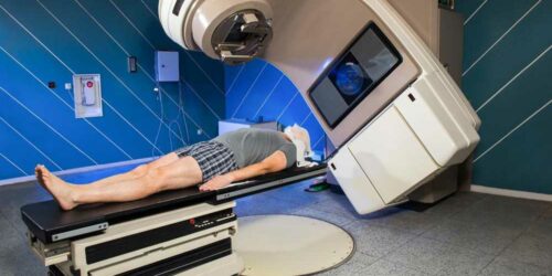 Know about the Types of Radiation Therapy