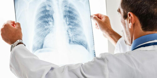 Know all about pulmonary embolisms