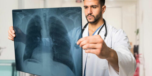 Know all about pulmonary fibrosis