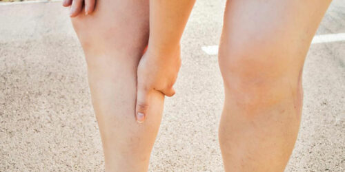 How cholesterol causes leg problems