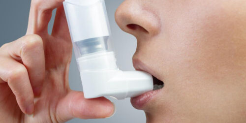 How is severe asthma treated?