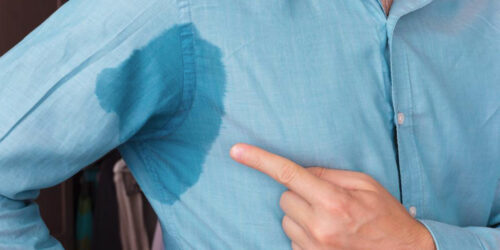 How to tackle excessive sweating