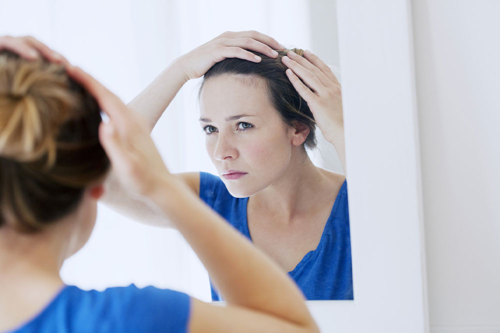 Hair loss and natural care tips to manage it