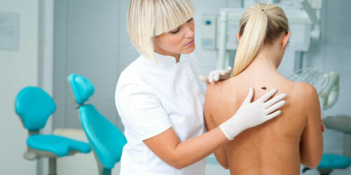 Here are a few common causes and symptoms of melanoma