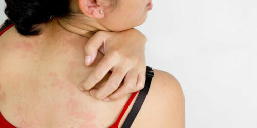 Here are a few common causes of itchy skin