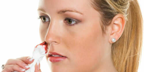 Here are the causes behind nose bleeding