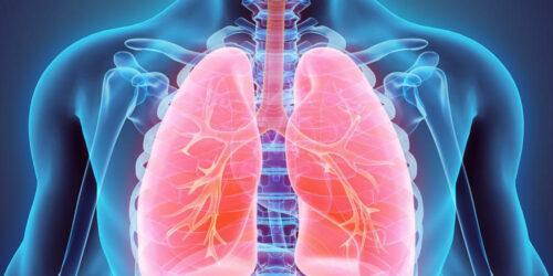 Here is a quick look at the common symptoms and treatments of lung cancer