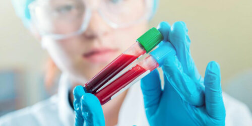 Here&#8217;s why maintaining normal creatinine levels is imperative