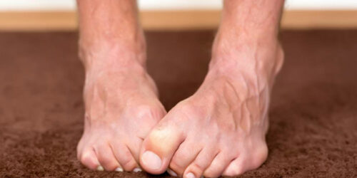 Important symptoms of neuropathy that should not be ignored