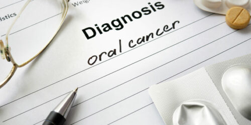 Oral Cancer &#8211; Symptoms, Causes and Management Options