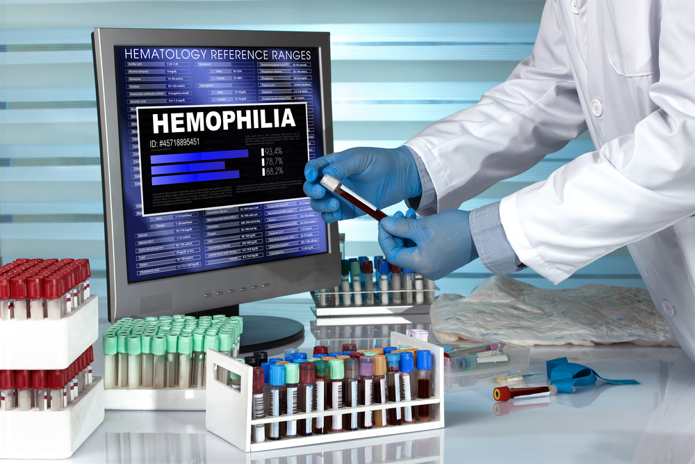 Overview: Hemophilia A and Hemophilia B