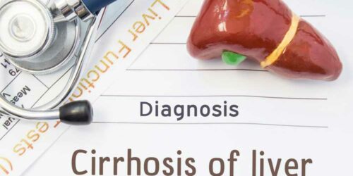 Liver Cirrhosis and its 4 Stages