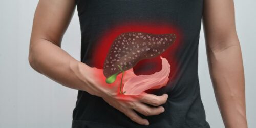 Liver cancer: Causes, symptoms, diagnosis, treatment, and prevention