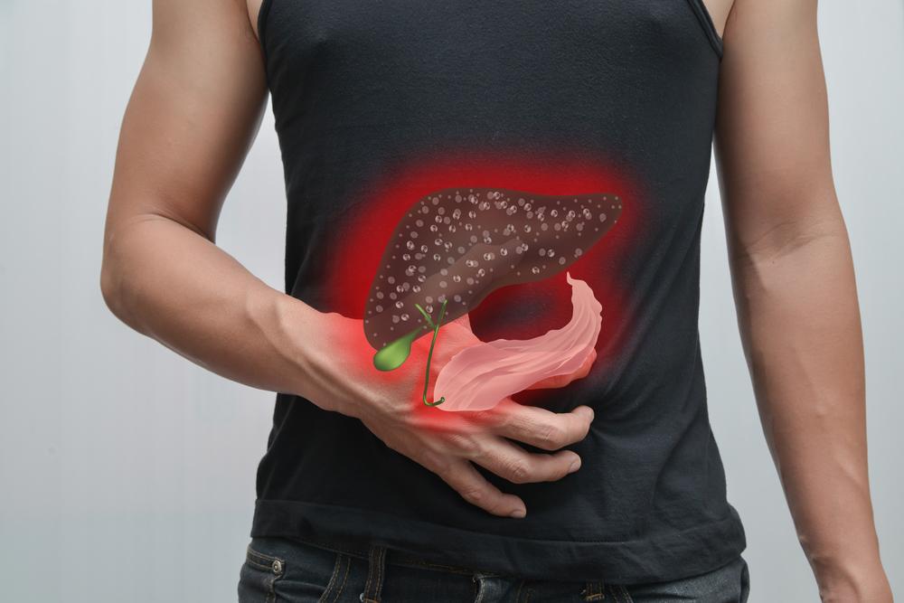 Liver cancer: Causes, symptoms, diagnosis, treatment, and prevention