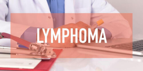 Non Hodgkin Lymphoma treatment &#8211; Symptoms, causes and more explained