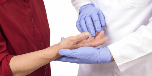 Some essential facts about rheumatoid arthritis and lupus