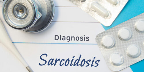 Sarcoidosis risk factors you should know about