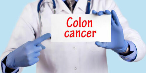 Signs and symptoms of colon cancer