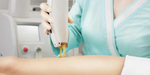 Simple options for body hair removal