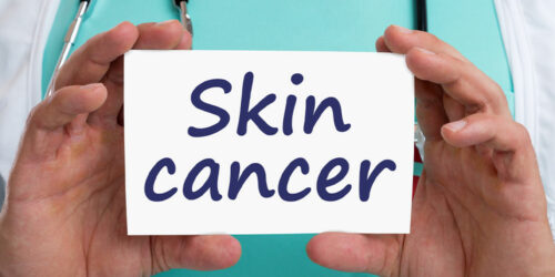 Skin Cancer &#8211; Types, Stages, and More