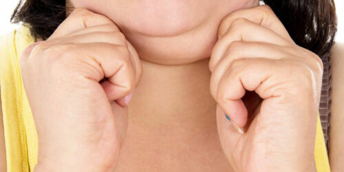 Struggling with a double chin? Here&#8217;s how you can get rid of it