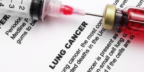 Survival Rates for Non-Small Cell Lung Cancer