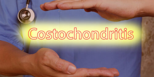 Symptoms, Causes, and Management of Costochondritis