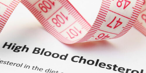 Symptoms, causes, and risks of high cholesterol