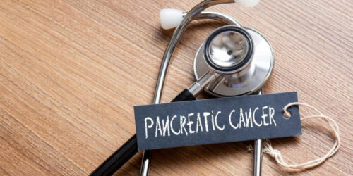 Pancreatic cancer, symptoms and treatment