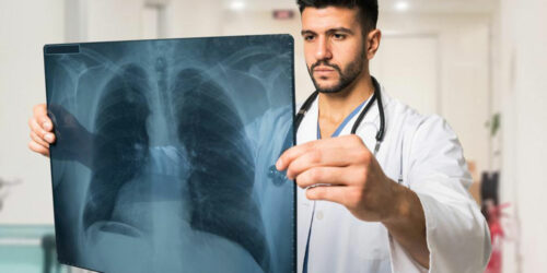 Protect your lungs from pulmonary embolism