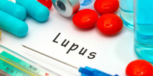 Remedies for Lupus