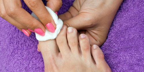 Ways to Cure Nail Fungus