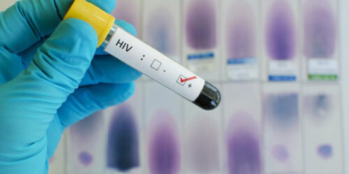 Ways to get diagnosed for HIV