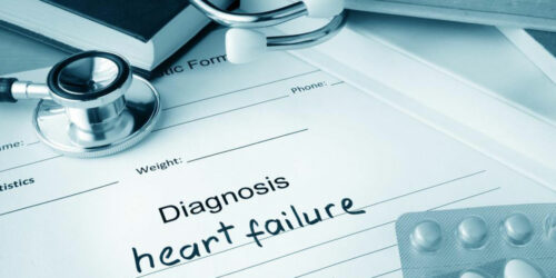 Ways to treat chronic heart failure