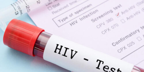 What are the early signs and symptoms of HIV infection?