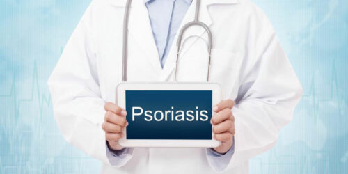 What are the possible plaque psoriasis treatments?