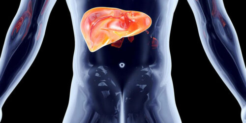 What does stage 4 Hepatitis C mean for your liver