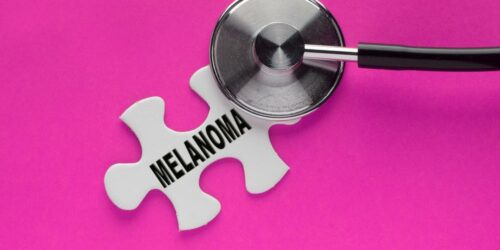 What is Melanoma Skin Cancer