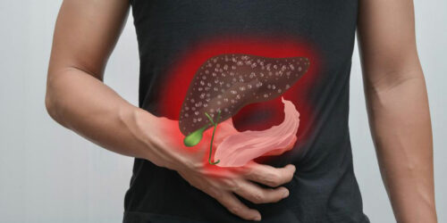 What is the relationship between Hepatitis C and liver damage