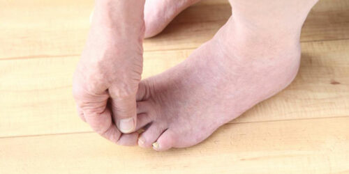 Taking a look at causes of foot pain