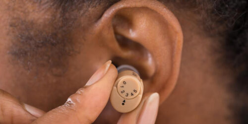 The cost factors for Hearing Aids