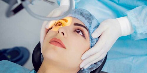 Things to Know Before a Cataract Surgery